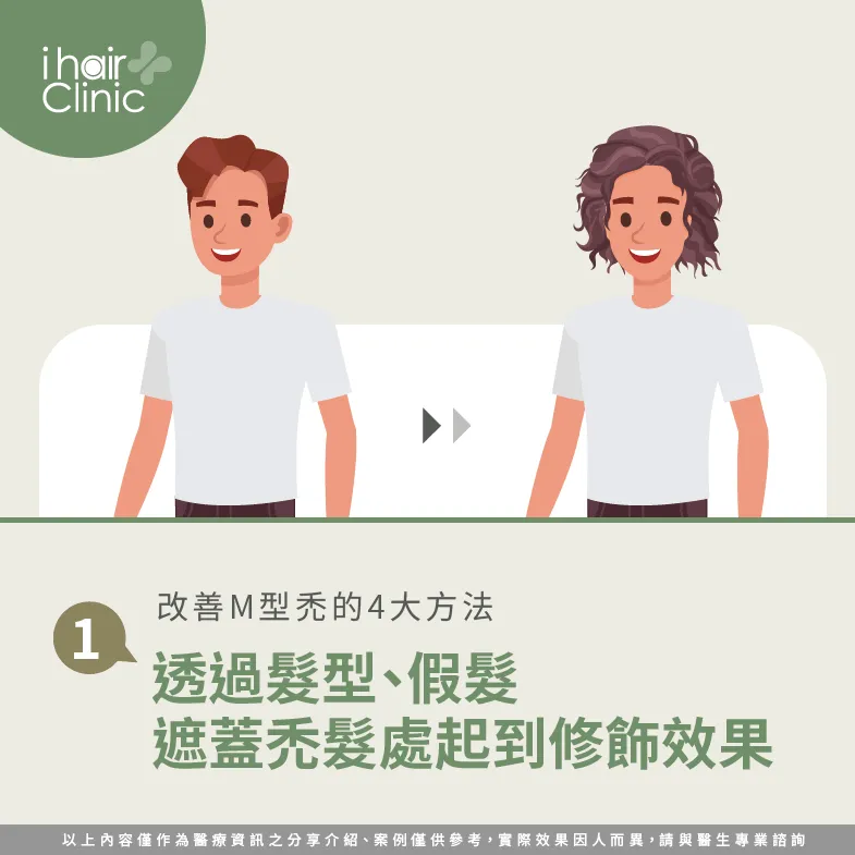M型禿可以暫時透過髮型及假髮遮蓋,來幫助修飾外表! 髮型及假髮修飾M型禿-M型禿 改善