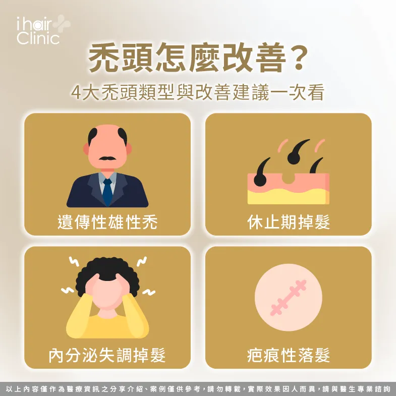 4種禿頭類型改善建議一次分享-禿頭 怎麼 改善