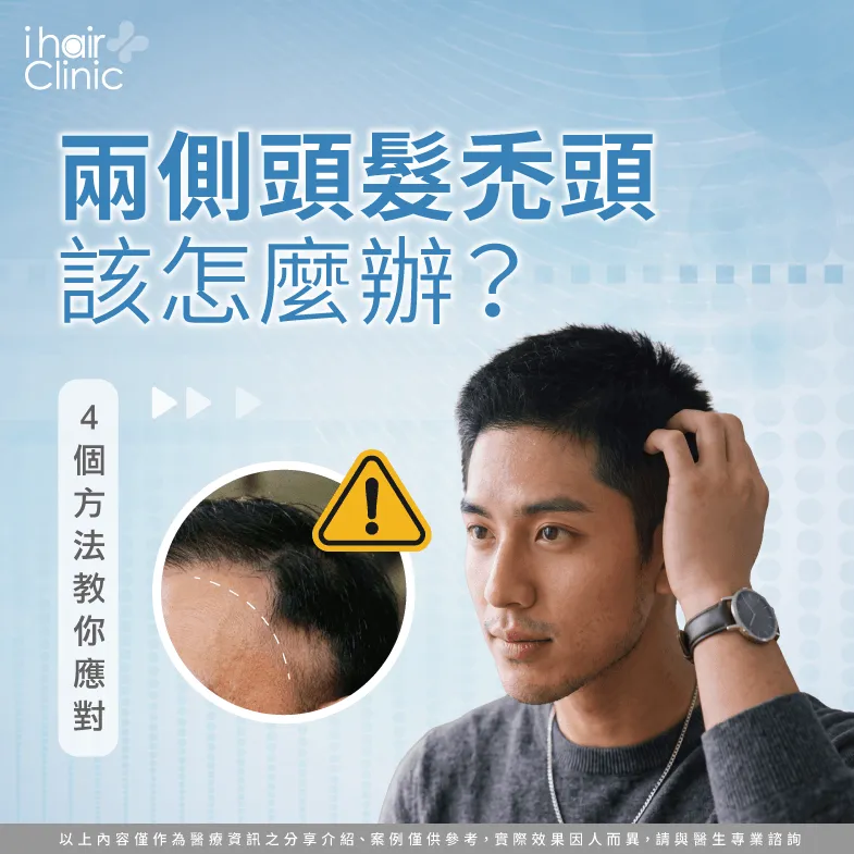 頭髮兩側禿頭-兩側頭髮稀疏