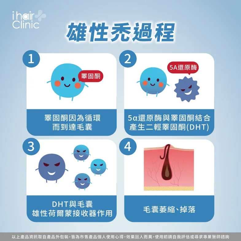 雄性禿的過程-頭髮兩側禿頭