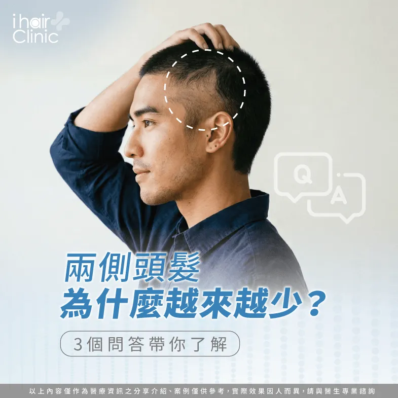為什麼兩側禿髮較少見?利用3個QA為你解答 3項頭髮兩側禿頭問答-兩側頭髮稀疏