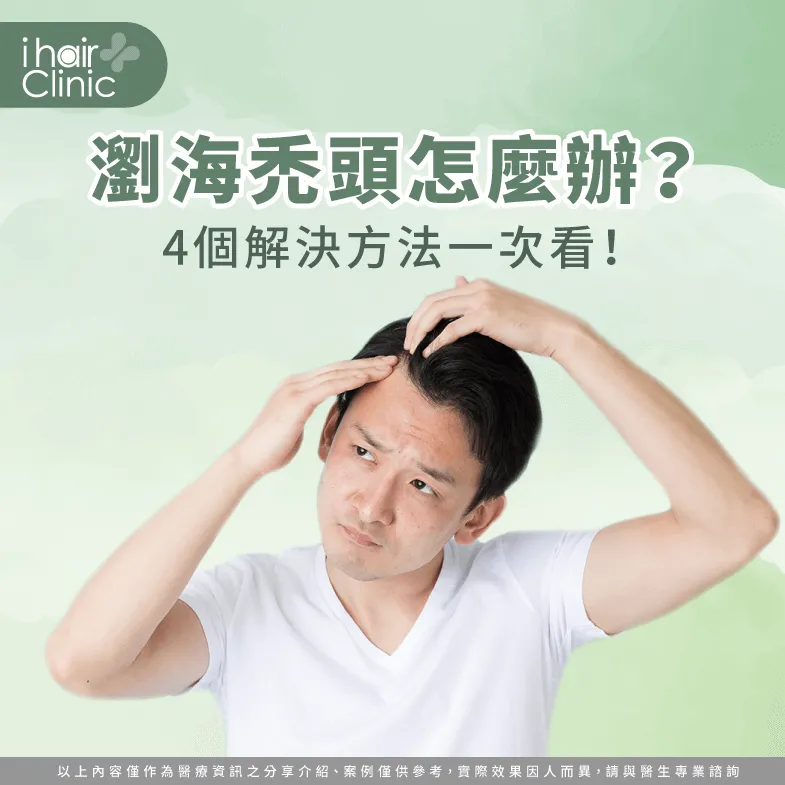 瀏海禿頭怎麼辦?本篇文章帶你了解4個改善方法! 4個方法解決瀏海禿頭-瀏海禿頭怎麼辦