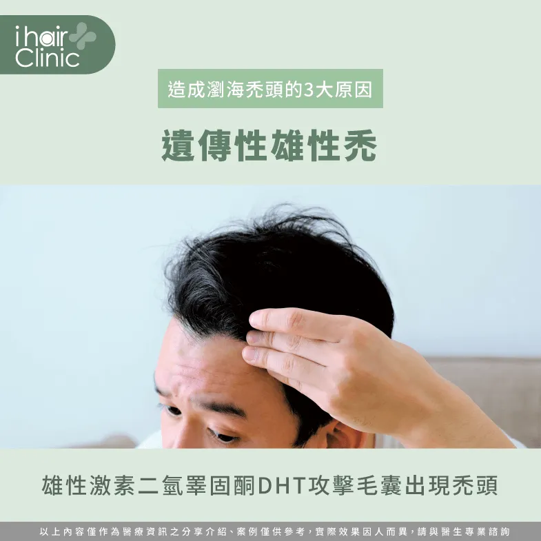 雄性禿會導致毛囊萎縮,出現掉髮導致瀏海禿頭! 雄性禿-瀏海禿頭怎麼辦