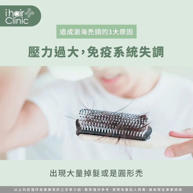 壓力過大會出現大量掉髮及圓形禿,導致瀏海禿頭! 壓力大導致掉髮-瀏海禿頭