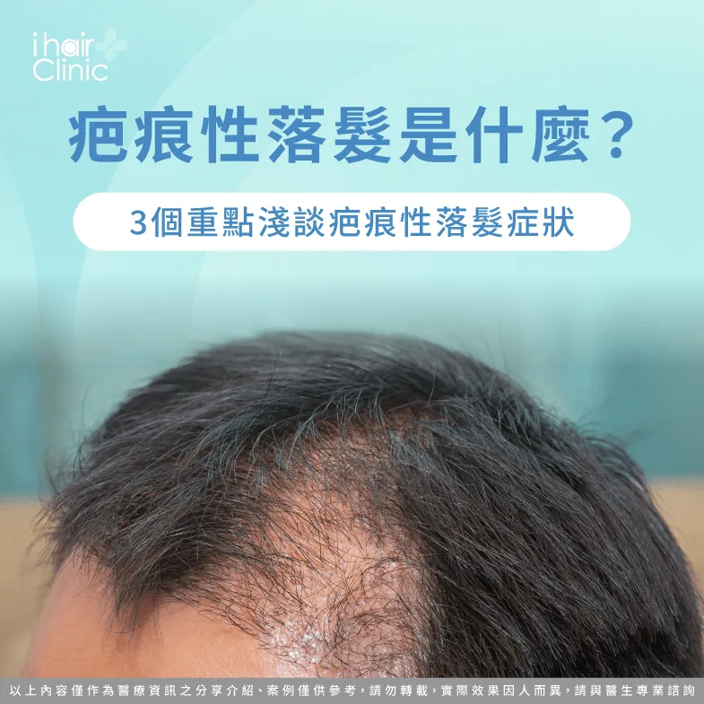 3個重點解析疤痕性落髮是什麼-疤痕性落髮