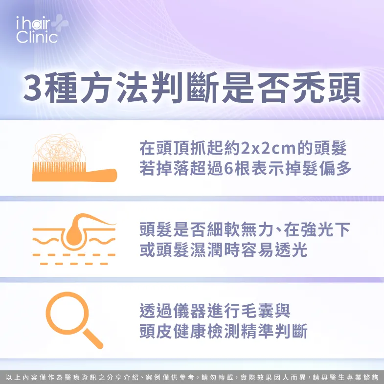 3種禿頭自測方法-禿頭初期徵兆