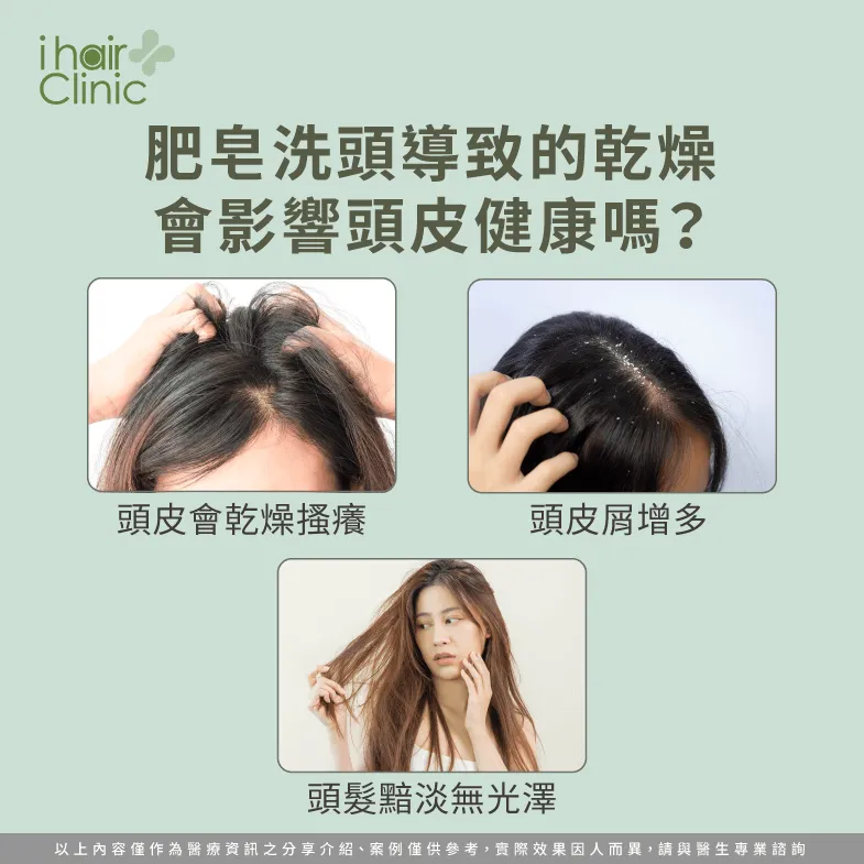 肥皂導致頭皮乾燥-肥皂洗頭會禿頭嗎