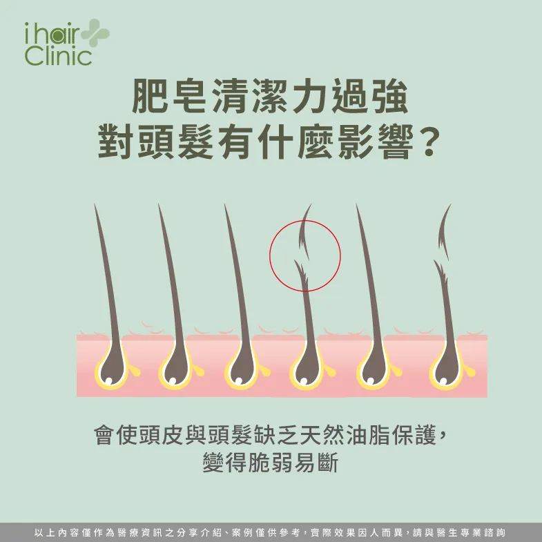 肥皂清潔力對頭皮的影響-肥皂洗頭會禿頭嗎