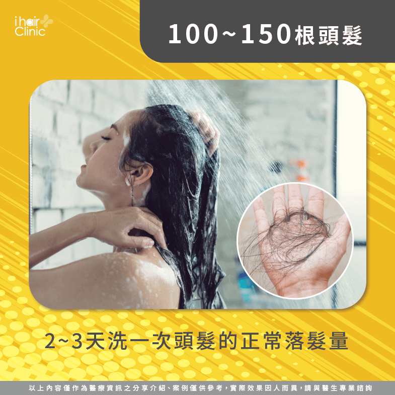 每天落髮100~150根-兩天洗一次頭掉髮量