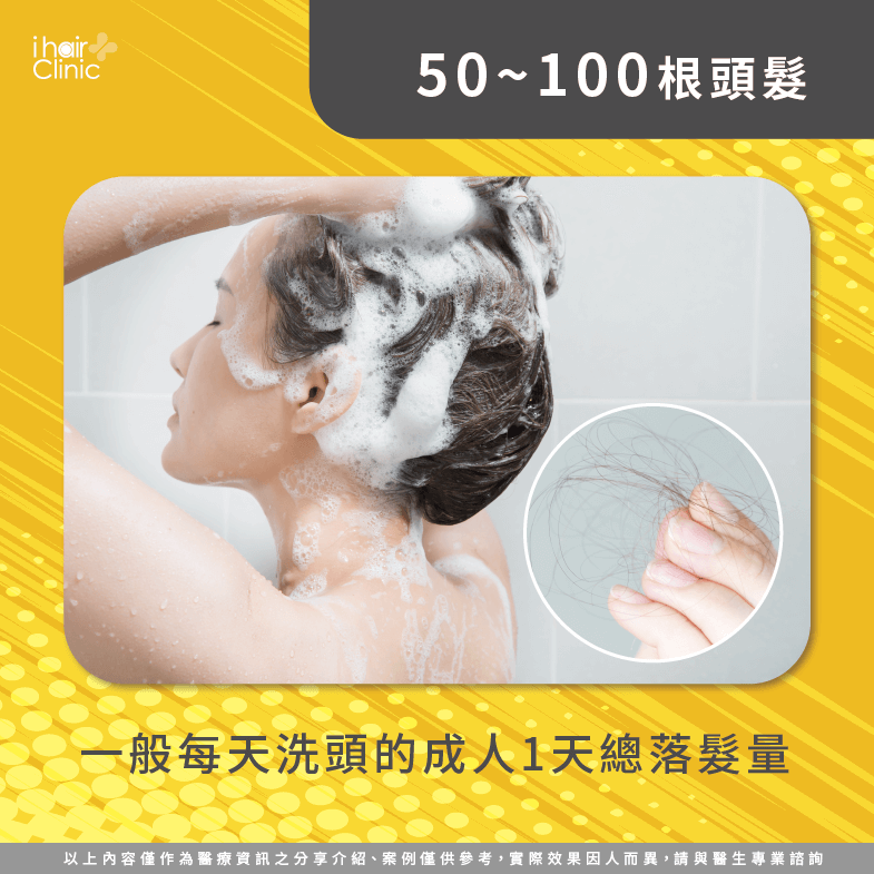 每天落髮50~150根-兩天洗一次頭掉髮量