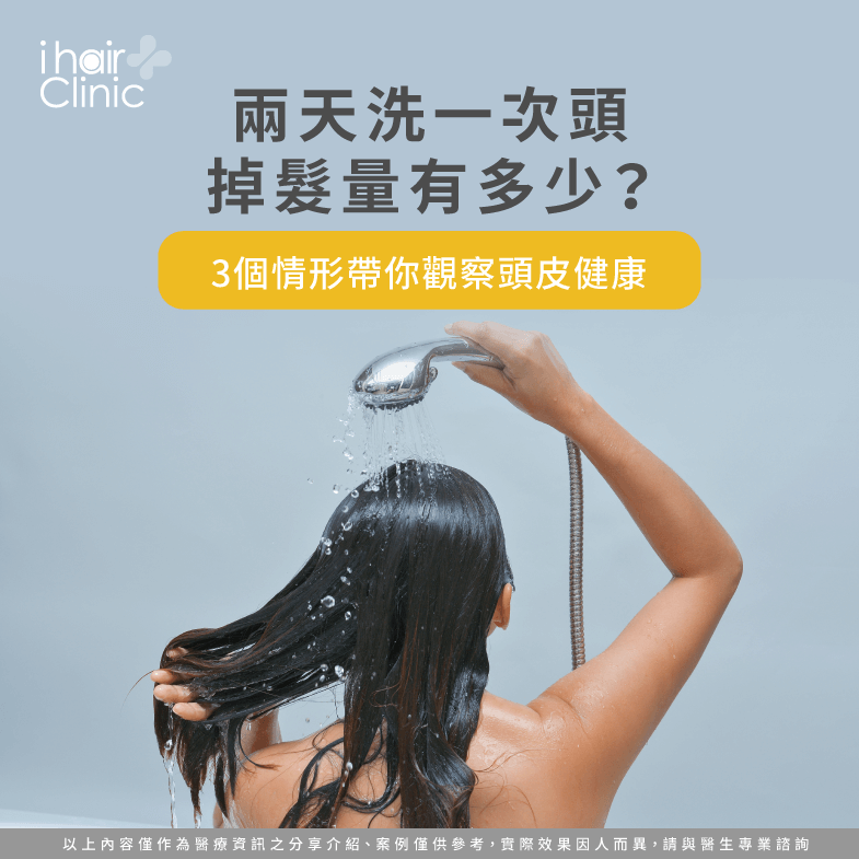 兩天洗一次頭掉髮量-兩天沒洗頭掉髮