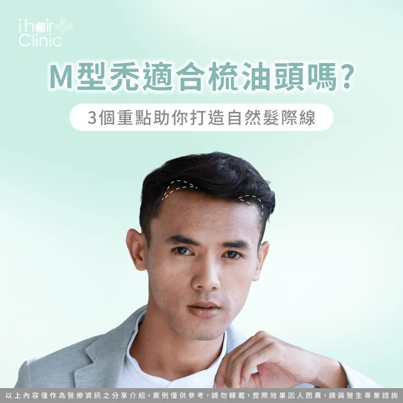 M型禿適不適合梳油頭的3個重點一次講解-M型禿 油頭