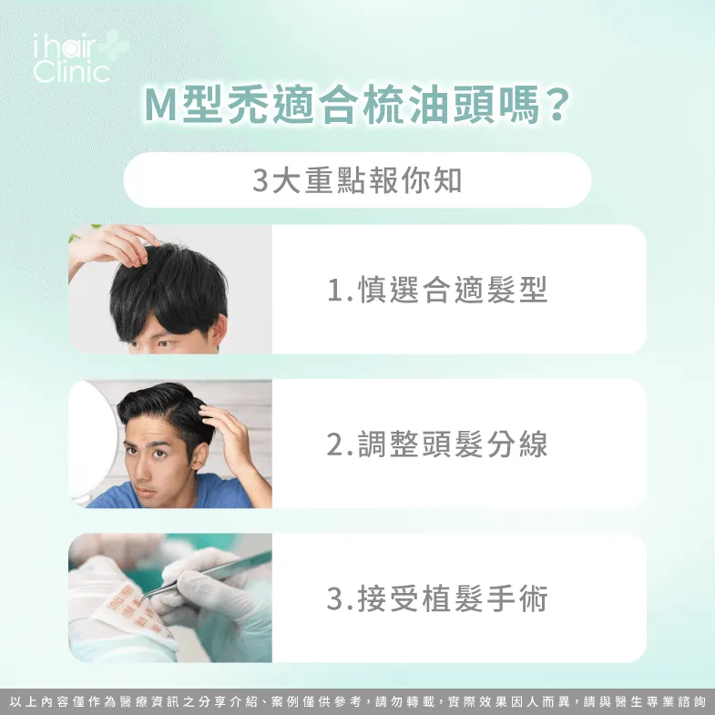 3個重點分析M型禿適合髮型有哪些-M型禿 髮型