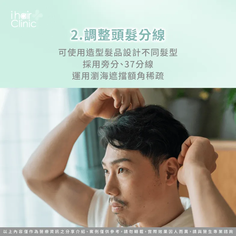 可調整髮型與瀏海分線掩飾額角缺髮-M型禿 髮型