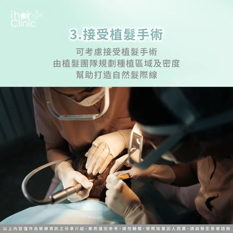透過植髮手術改善髮際線倒退-M型禿 油頭