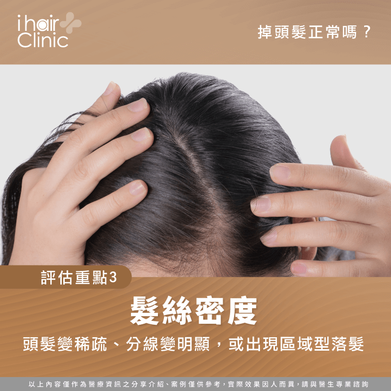 掉頭髮是正常的嗎 3項關鍵自我評估 Ihair風華御髮