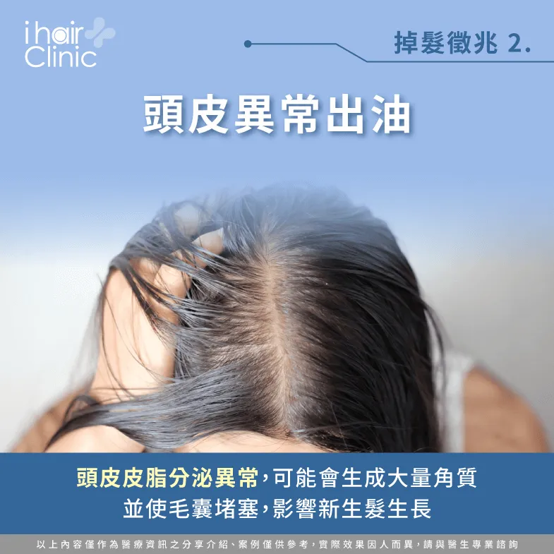 頭皮異常出油可能會導致毛囊堵塞-頭皮不健康 掉髮