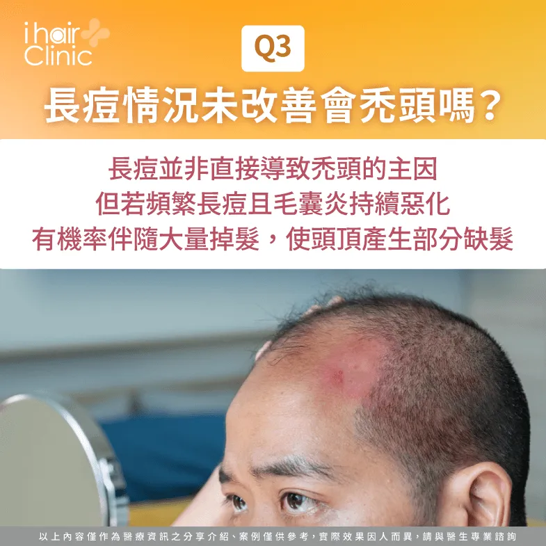 頭皮長痘症狀惡化可能會禿髮-頭皮長痘痘 禿頭