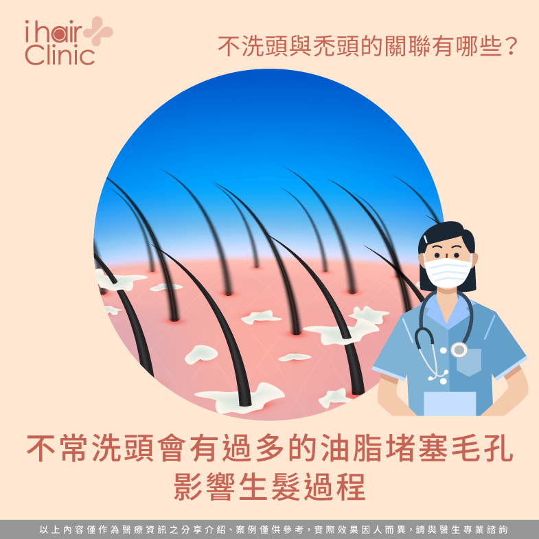 不洗頭會禿頭嗎?不洗頭掉頭髮的3項因素一次告訴你ihair風華御髮