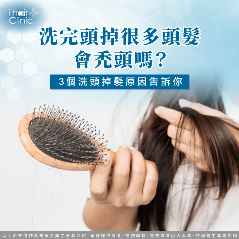 洗完頭掉很多頭髮-洗頭一直掉頭髮