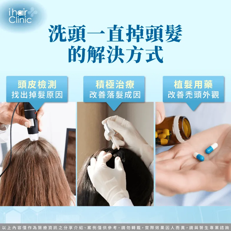 解決洗髮落髮情形的3個方式-洗完頭掉很多頭髮