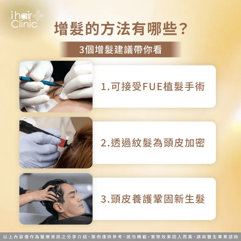 增髮的方法除了植髮外還有哪些?3個推薦方式告訴你 幫助增加髮量的3個方法一次看-增髮 植髮