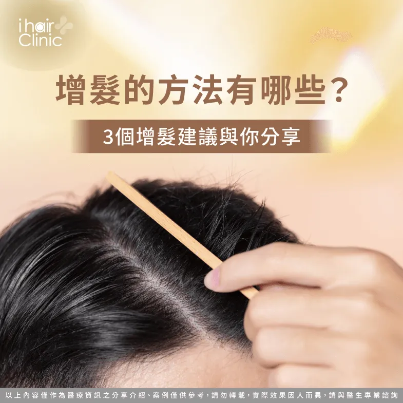 增髮的方法有哪些?3個推薦增髮方式一次帶你了解 3個重點告訴你增髮的方法有哪些-增髮的方法