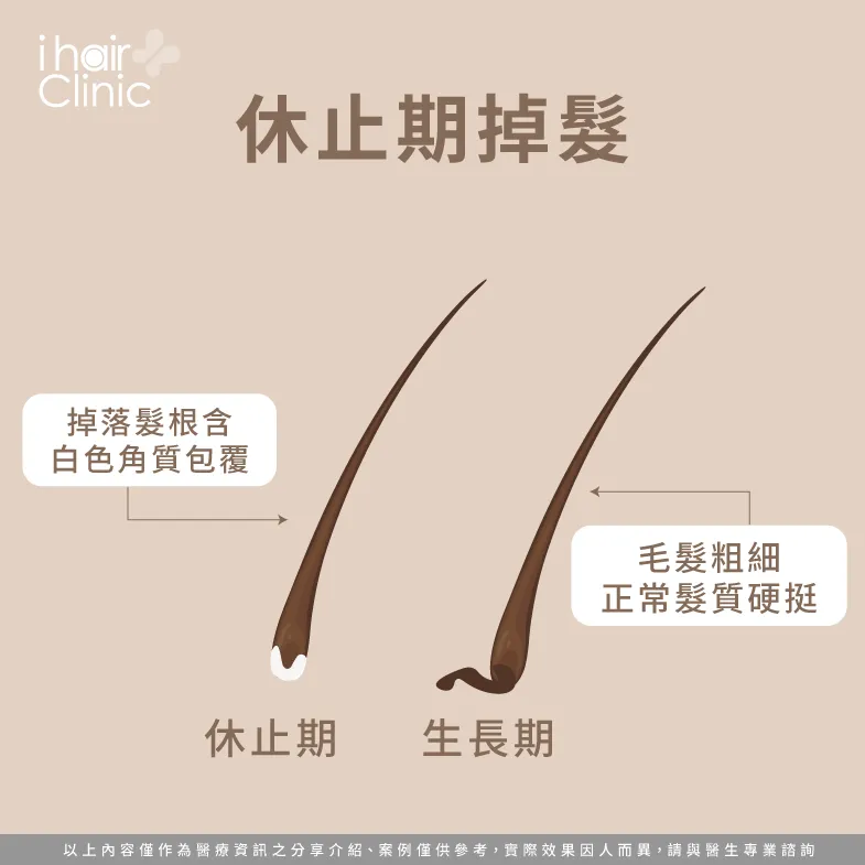 休止期掉髮-掉髮會長回來嗎