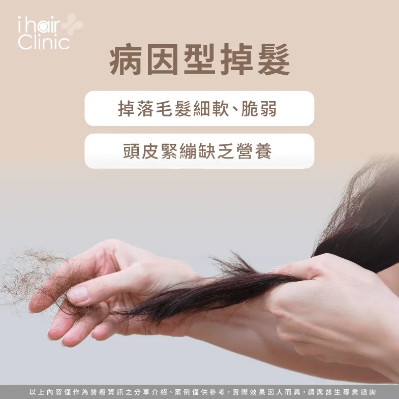病因型掉髮-掉髮會長回來嗎