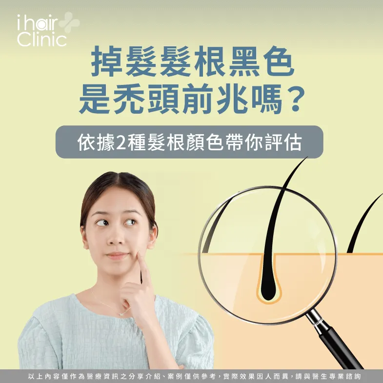 掉髮髮根黑色-掉髮髮根白