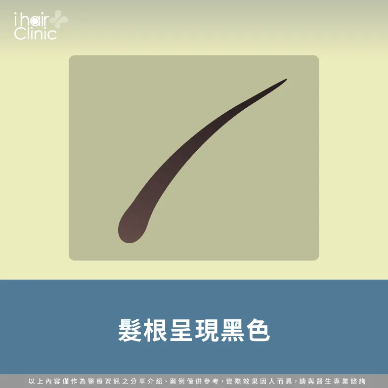 掉髮髮根黑-掉髮髮根黑色-掉髮髮根白