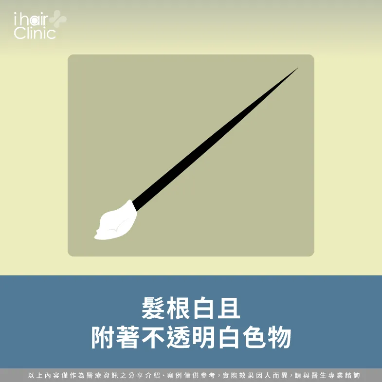 髮根白伴隨不透明白色物質-掉髮髮根黑色-掉髮髮根白