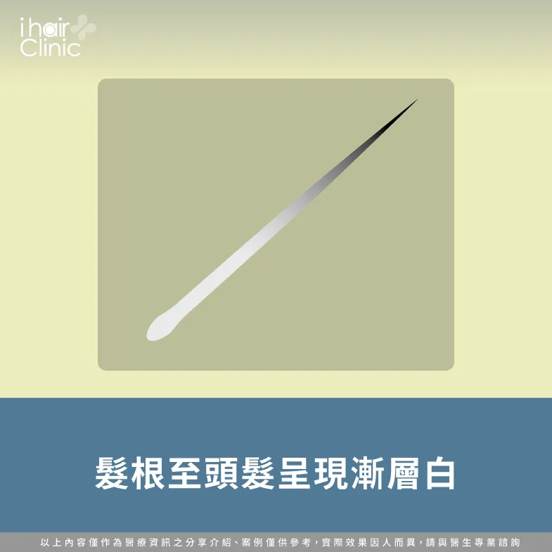 髮根區域全白-掉髮髮根黑色-掉髮髮根白