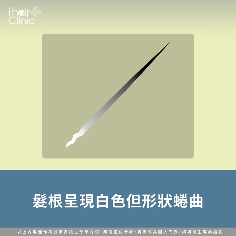 髮根白但彎曲-掉髮髮根黑色-掉髮髮根白