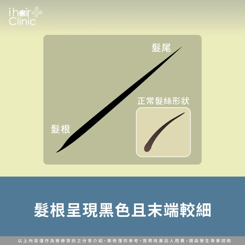 髮尾黑且末端細-掉髮髮根黑色-掉髮髮根白