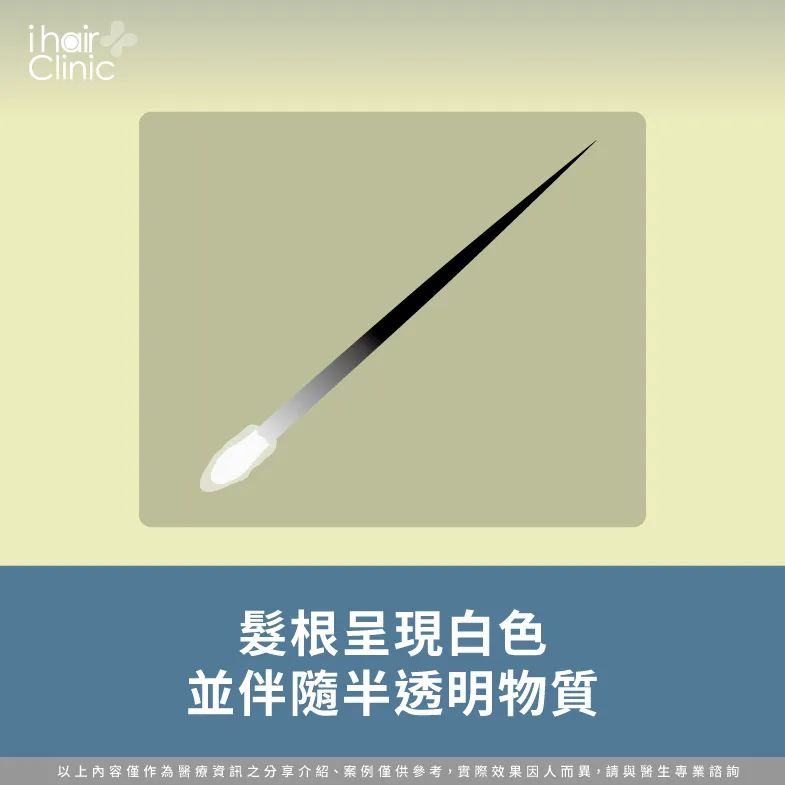 髮根白伴隨半透明物質-掉髮髮根黑色-掉髮髮根白