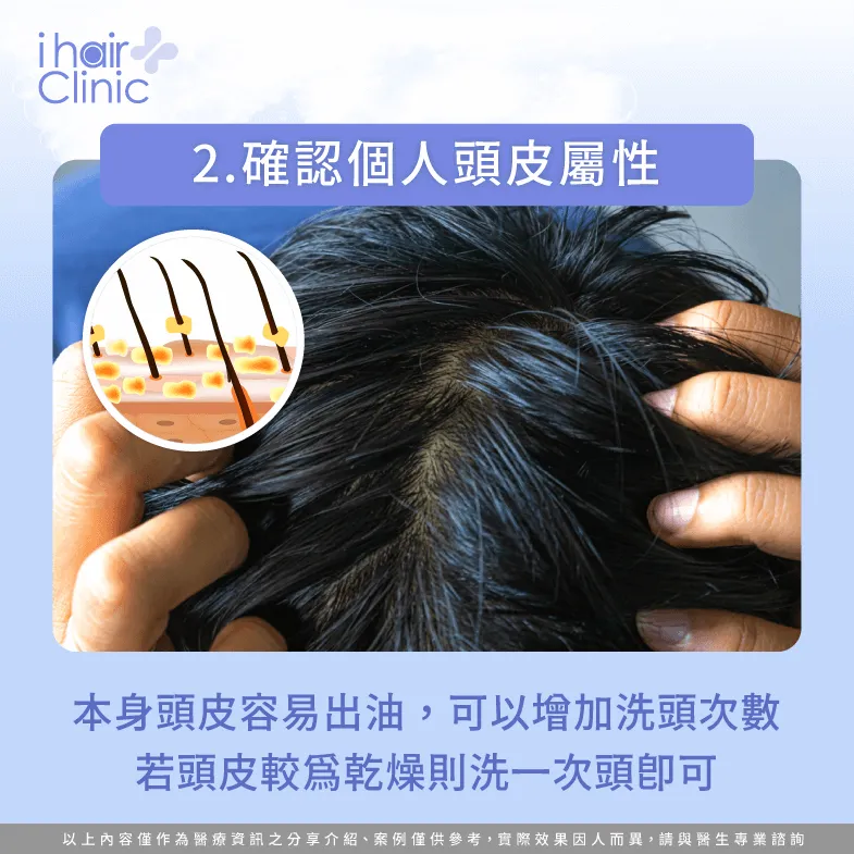 建議可根據頭皮屬性調整洗頭次數-掉髮 洗髮次數