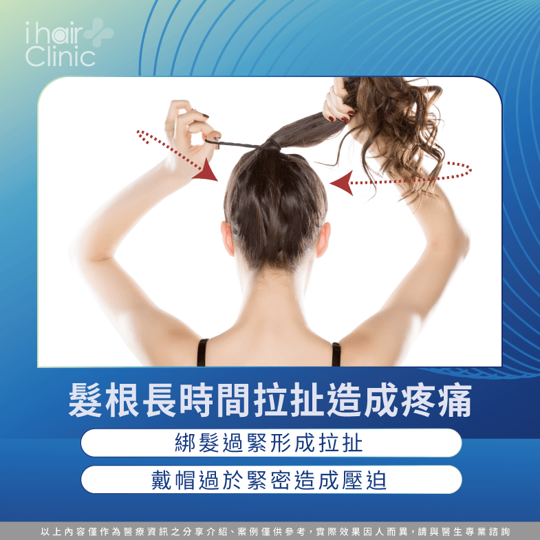 拉扯髮根造成頭皮痛-撥頭髮頭皮痛