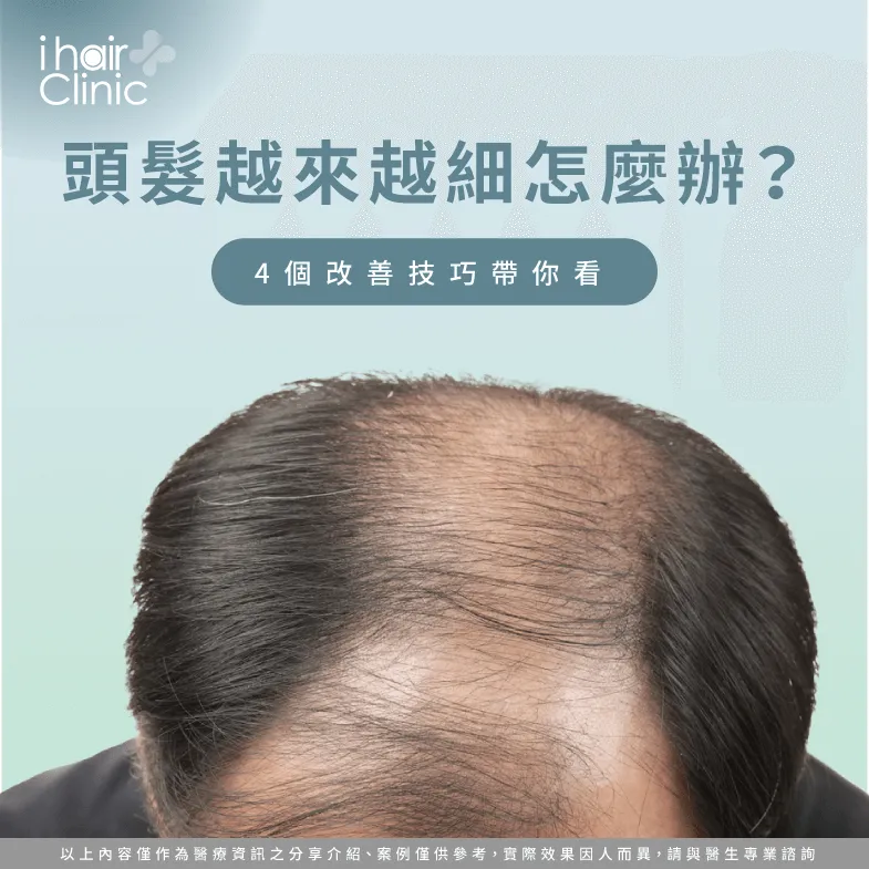 頭髮越來越細怎麼辦?4種技巧幫助你輕鬆解決 頭髮越來越細怎麼辦-頭髮變細的原因