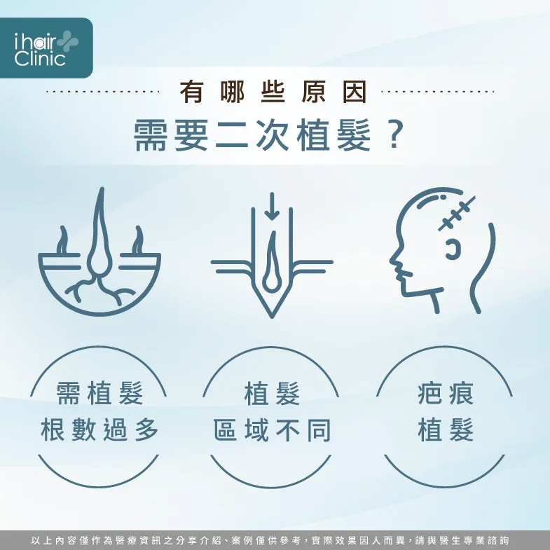 確認是否真的需要二次植髮-植髮費用多少