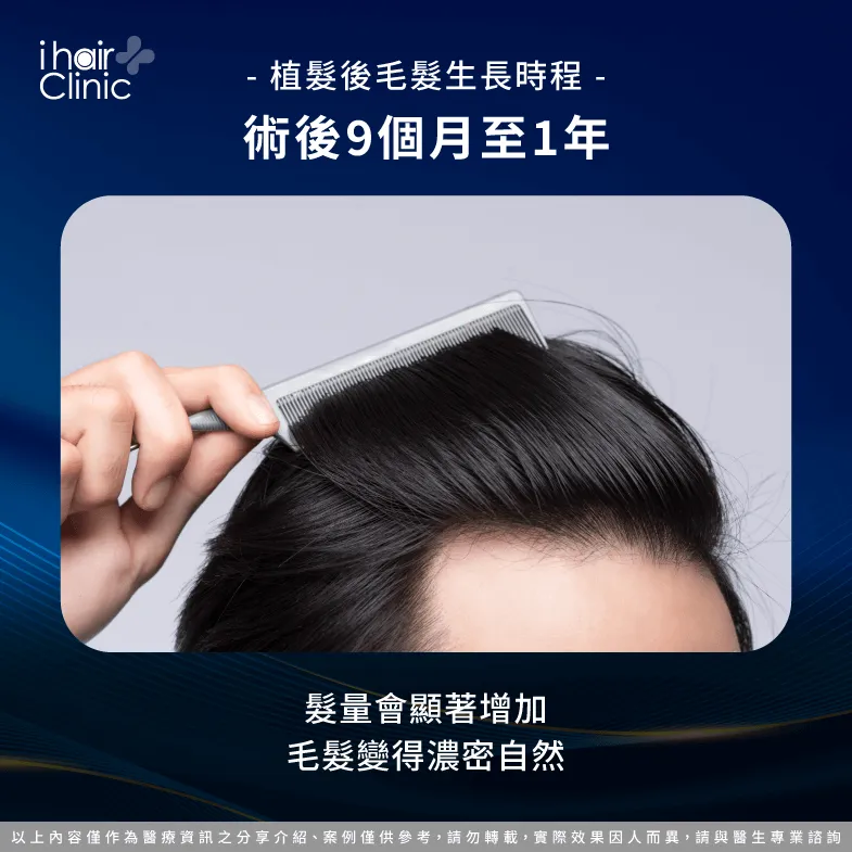 9-12個月最終成果- 植髮後會自然生長嗎