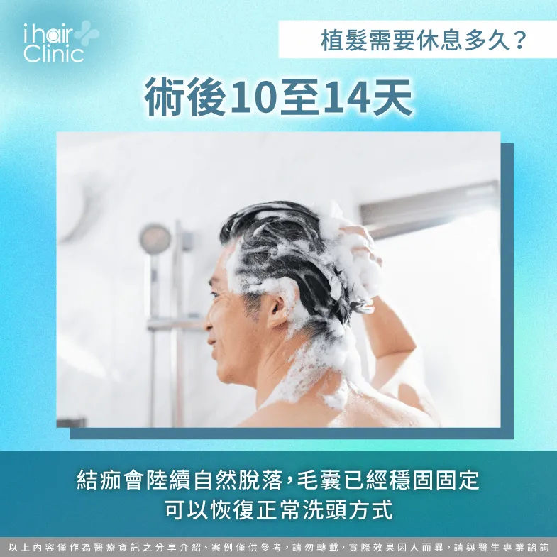 術後14天穩固期過後,毛囊已與頭皮組織融合,可恢復日常清潔力度 術後10-14天恢復洗頭-植髮需要休息多久