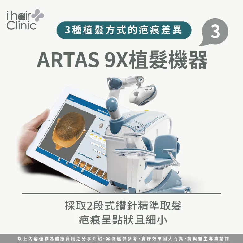 ARTAS 9X植髮機器術後疤痕小-植髮會留疤嗎