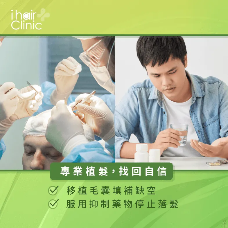 透過植髮改善髮旋禿-髮旋禿怎麼辦