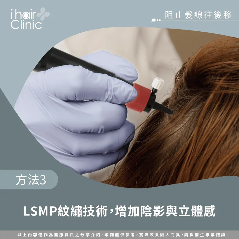 LSMP紋髮技術-髮線變寬