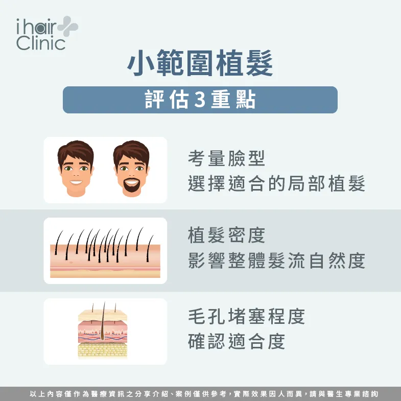 小範圍植髮的3個評估重點-局部植髮