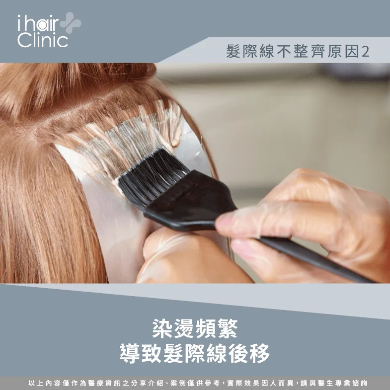 經常染燙導致髮際線不平整-髮際線不整齊