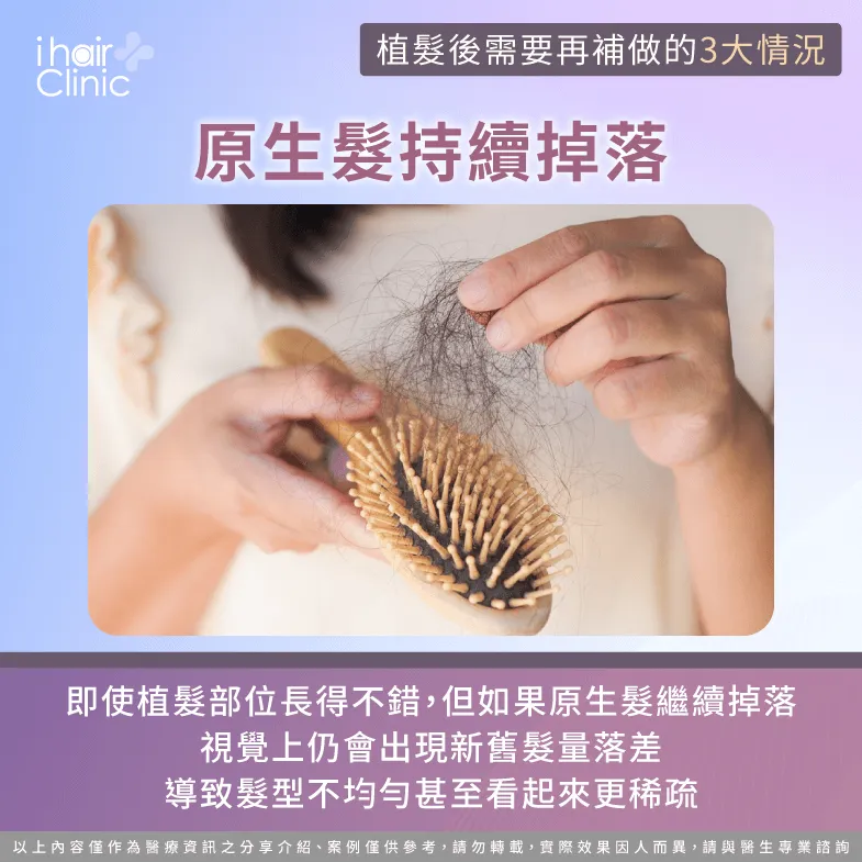 原生髮持續掉落-植髮後需要再補做嗎