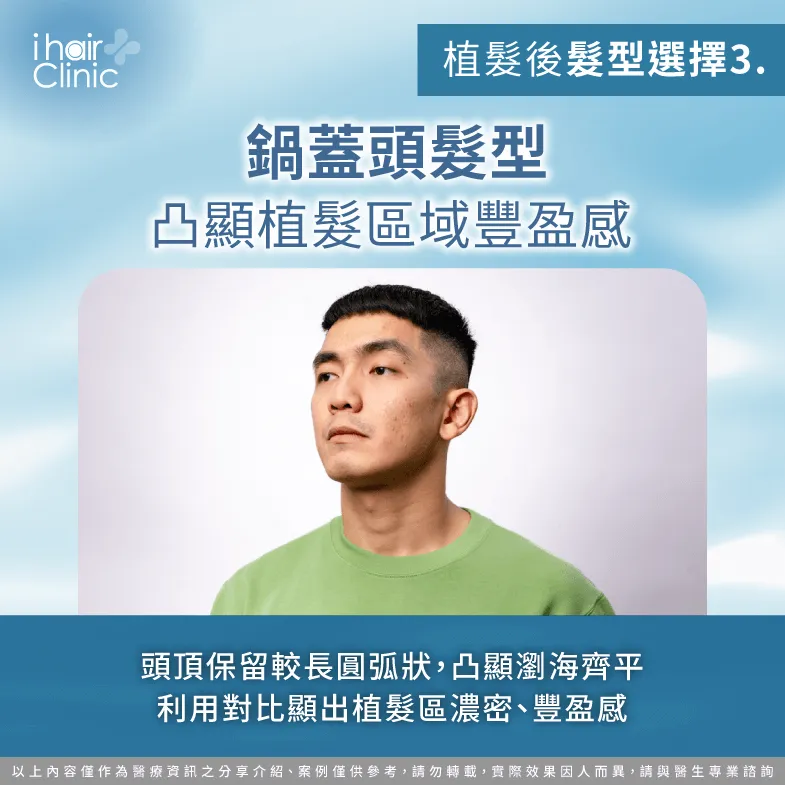 鍋蓋頭髮型凸顯植髮效果-植髮後髮型