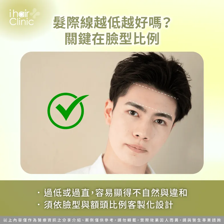 比例與臉型-M型禿 植髮 髮際線設計